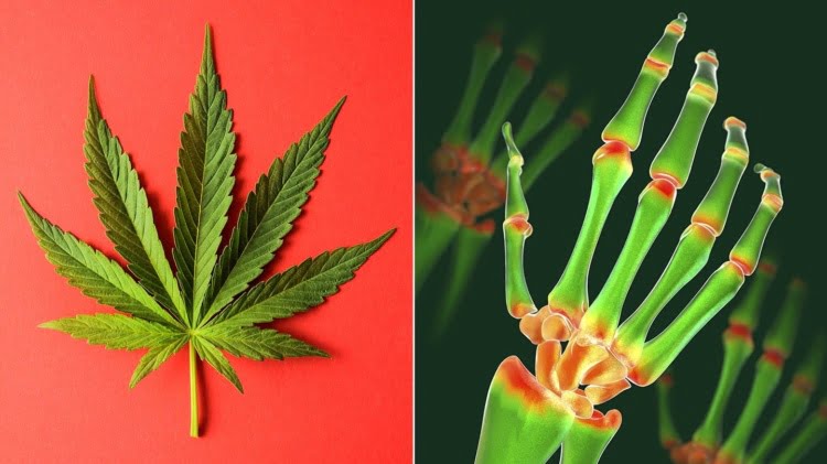 Is Marijuana Good for Pain