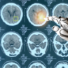 Medical Imaging and Deep Learning: How The Two Fit Together