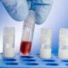 Dubai: Differences Between Private And Public Cord Blood Banks
