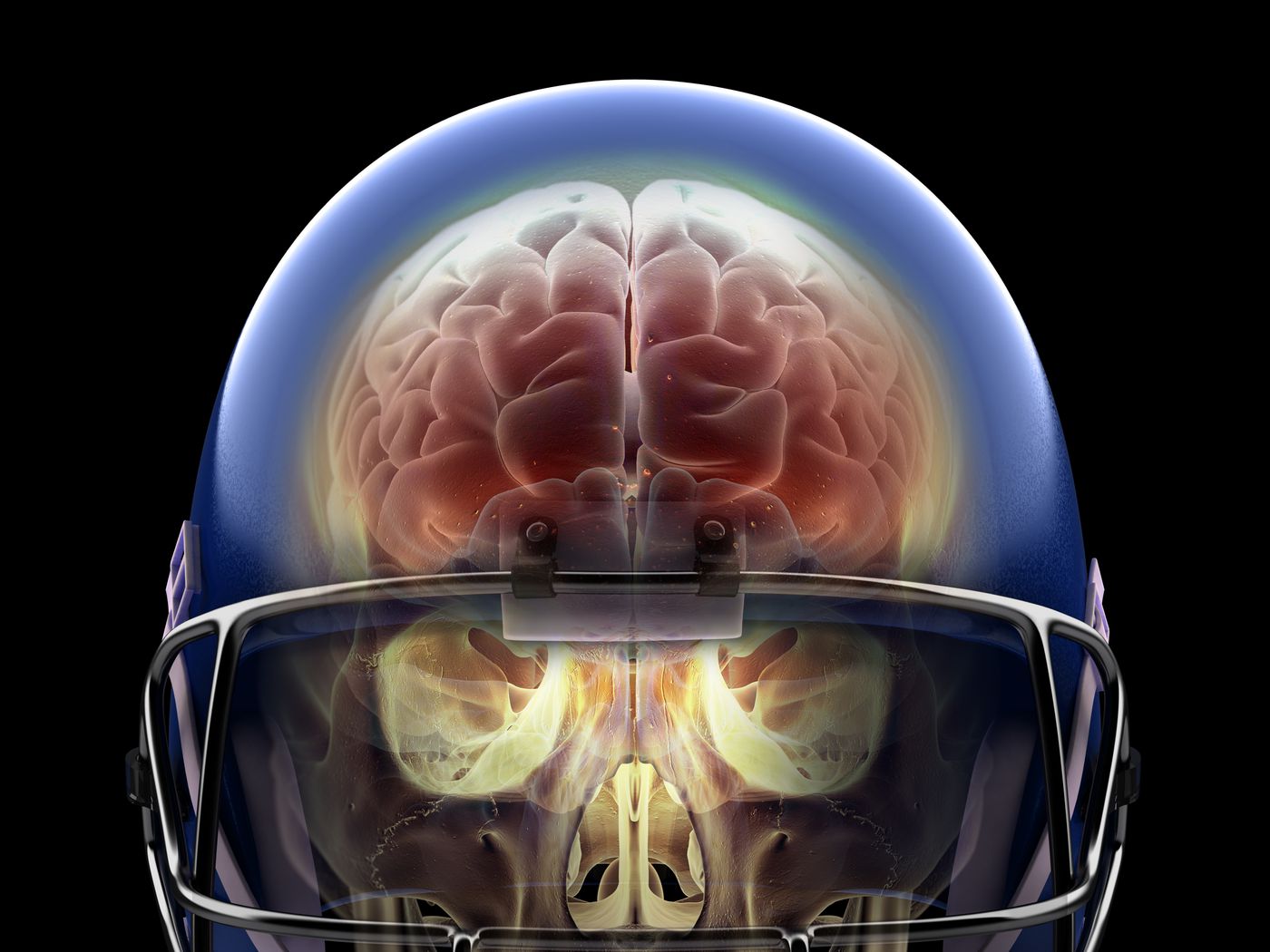 NFL concussions. By Getty Images