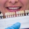 Types of Dental Crowns Choosing the Right Material in Yakima