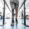 Male amputee with prosthesis using rehabilitation equipment. Man learning to walk again. Rehabilitation, recovery, determination, physiotherapy.