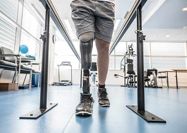 Male amputee with prosthesis using rehabilitation equipment. Man learning to walk again. Rehabilitation, recovery, determination, physiotherapy.